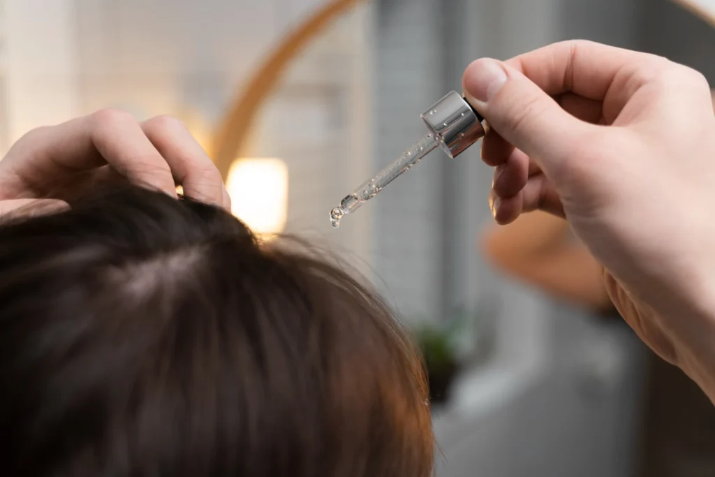 minoxidil használata